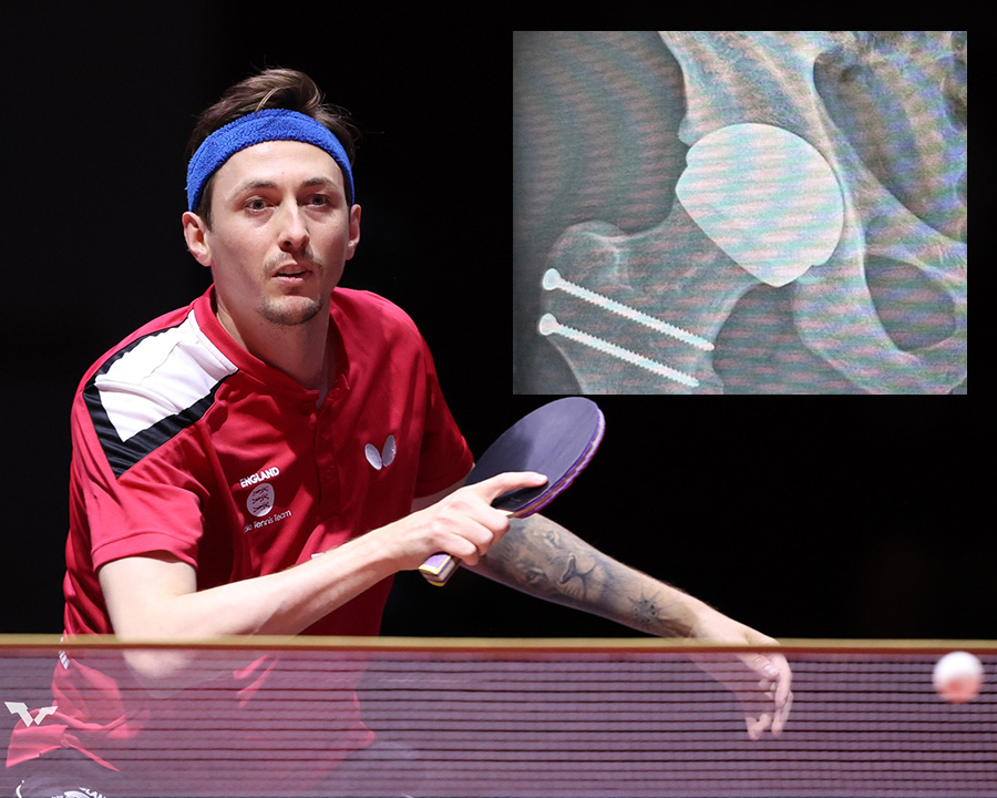 Liam Pitchford on the recovery trail after surgery by leading hip specialist